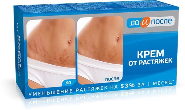 До и После Крем от растяжек 100мл