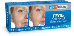 До и После Тотал Лифтинг гель для лица 50мл